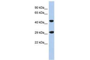 Image no. 1 for anti-Chromosome 22 Open Reading Frame 25 (C22orf25) (N-Term) antibody (ABIN6743715)
