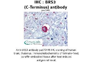 Image no. 1 for anti-Bombesin-Like Receptor 3 (BRS3) (C-Term), (Cytoplasmic Domain) antibody (ABIN1732418) (BRS3 antibody  (C-Term, Cytoplasmic Domain))