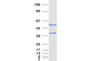 Validation with Western Blot