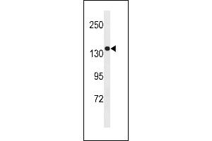 SGSM1 Antibody (Center) (ABIN1881801 and ABIN2843255) western blot analysis in MDA-M cell line lysates (35 μg/lane). (SGSM1 antibody  (AA 624-652))