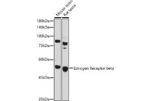 Western blot analysis of extracts of various cell lines, using Estrogen Receptor beta antibody (ABIN3016231, ABIN3016232, ABIN3016233 and ABIN6219642) at 1:1000 dilution. (ESR2 antibody  (AA 1-280))