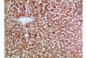 Immunohistochemistry (IHC) image for anti-Thymopoietin (TMPO) (AA 1-50) antibody (ABIN7189405)