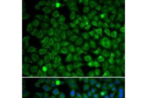 Immunofluorescence analysis of U2OS cells using NUP62 Polyclonal Antibody (NUP62 antibody)