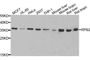 Western blot analysis of extracts of various cell lines, using RPS2 antibody. (RPS2 antibody)