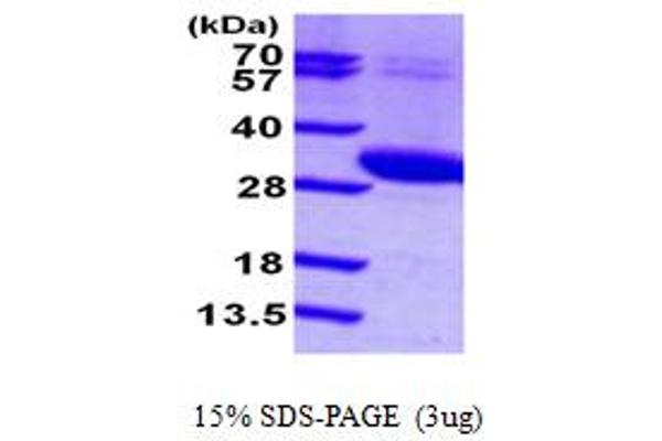 UCK2 Protein (AA 1-261) (His tag)