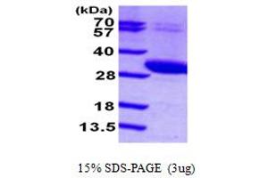 SDS-PAGE (SDS) image for Uridine-Cytidine Kinase 2 (UCK2) (AA 1-261) protein (His tag) (ABIN667281)