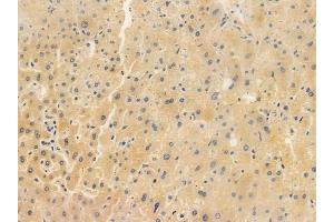 ABIN6265555 and ABIN6266853 at 1/100 staining human normal liver tissue by IHC-P.