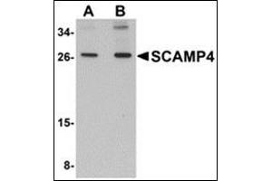 Western blot analysis of SCAMP4 in 3T3 cell lysate with this product at (A) 1 and (B) 2 μg/ml.