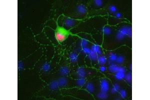 Indirect immunostaining of PFA fixed rat hippocampus neurons with anti-Ctip 2 (dilution 1 : 500; red) and mouse anti-MAP 2 (cat. (BCL11B antibody)