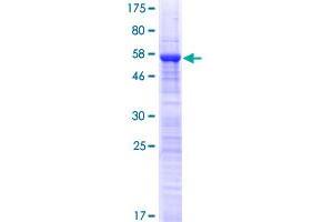 Image no. 1 for UV Stimulated Scaffold Protein A (UVSSA) (AA 1-260) protein (GST tag) (ABIN1308621) (UVSSA/KIAA1530 Protein (AA 1-260) (GST tag))