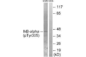 Immunohistochemistry analysis of paraffin-embedded human lymph node tissue using IκB-α (Phospho-Tyr305) antibody. (NFKBIA antibody  (pTyr305))