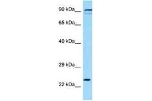 Image no. 1 for anti-Killer Cell Lectin-Like Receptor Subfamily K, Member 1 (KLRK1) (AA 121-170) antibody (ABIN6748394) (KLRK1 antibody  (AA 121-170))