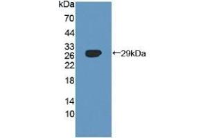 Detection of Recombinant SNX13, Human using Polyclonal Antibody to Sorting Nexin 13 (SNX13) (SNX13 antibody  (AA 97-284))