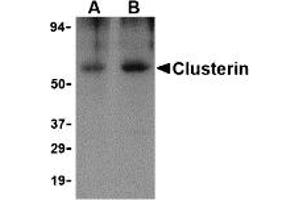 Western Blotting (WB) image for anti-Clusterin (CLU) antibody (ABIN1031714) (Clusterin antibody)
