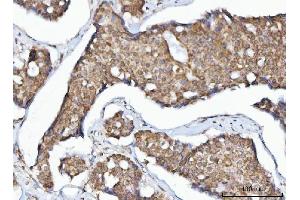 IHC analysis of MFF using anti-MFF antibody (ABIN7599292). (MFF antibody  (AA 1-342))