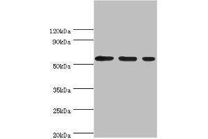 Western blot All lanes: Aladin antibody at 5 μg/mL Lane 1: Hela whole cell lysate Lane 2: Mouse brain tissue Lane 3: NIH/3T3 whole cell lysate Secondary Goat polyclonal to rabbit IgG at 1/10000 dilution Predicted band size: 60, 56 kDa Observed band size: 60 kDa (Adracalin antibody  (AA 287-546))