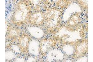 ABIN7096416 and ABIN7100480 at 1/100 staining human normal kidney tissue by IHC-P.