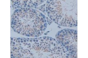 Figure. (PFN1 antibody  (AA 2-140))
