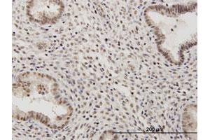 Immunoperoxidase of purified MaxPab antibody to RSC1A1 on formalin-fixed paraffin-embedded human endometrium. (RSC1A1 antibody  (AA 1-617))
