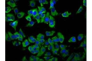 Immunofluorescence staining of MCF-7 cells with ABIN7173159 at 1:66, counter-stained with DAPI. (TMEM231 antibody  (AA 161-261))