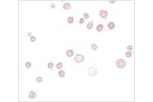 Immunocytochemistry of FREM1 in K562 cells with FREM1 antibody at 20 μg/ml. (FREM1 antibody  (C-Term))