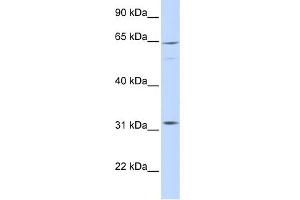 WB Suggested Anti-ARHGAP25 Antibody Titration: 0. (ARHGAP25 antibody  (Middle Region))