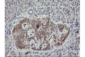 Immunohistochemistry (IHC) image for anti-Eukaryotic Translation Initiation Factor 5A2 (EIF5A2) antibody (ABIN1497996) (EIF5A2 antibody)