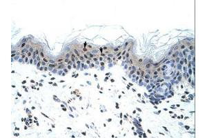 Image no. 1 for anti-Sodium Channel, Voltage-Gated, Type V, alpha Subunit (SCN5A) (AA 1856-1905) antibody (ABIN6736314) (SCN5A antibody  (AA 1856-1905))