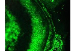 Image no. 1 for anti-Cardiotin antibody (ABIN959480) (Cardiotin antibody)