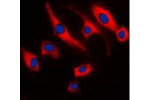 Immunofluorescent analysis of SCC-S2 staining in Raw264. (TNFAIP8 antibody  (Center))