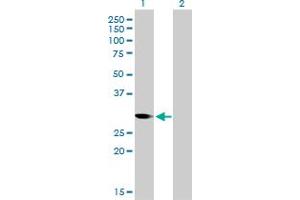 Western Blot analysis of CDC2 expression in transfected 293T cell line by CDC2 monoclonal antibody (M01), clone 1A4-1A9. (CDK1 antibody  (AA 1-297))