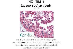 Image no. 1 for anti-Hepatitis A Virus Cellular Receptor 1 (HAVCR1) (AA 200-300) antibody (ABIN1740077) (HAVCR1 antibody  (AA 200-300))