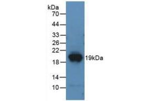 Western blot analysis of recombinant Mouse DPP4. (DPP4 antibody  (AA 29-178))