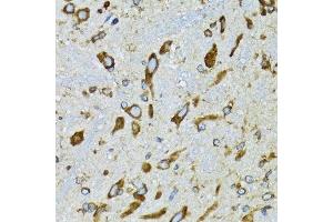 Immunohistochemistry of paraffin-embedded mouse spinal cord using RPN1 antibody.