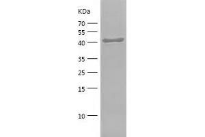 Western Blotting (WB) image for CD44 (CD44) (AA 152-311) protein (His-IF2DI Tag) (ABIN7282181) (CD44 Protein (CD44) (AA 152-311) (His-IF2DI Tag))