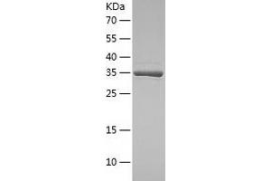 Histo-blood group A transferase (ABO) (AA 54-354) protein (His-IF2DI Tag)
