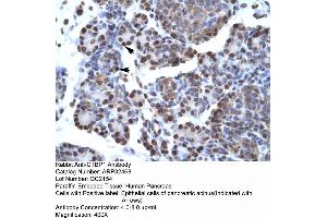 Human Pancreas (CTBP1 antibody  (C-Term))
