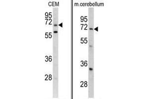 Western blot analysis of GARP antibody (Center) Cat. (LRRC32 antibody  (AA 240-269))