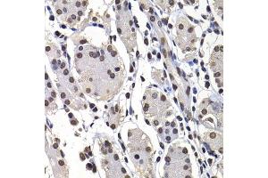 Immunohistochemistry of paraffin-embedded human stomach using macroH2A.