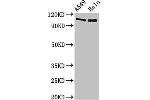 Western Blot Positive WB detected in: A549 whole cell lysate, Hela whole cell lysate All lanes: EML4 antibody at 3 μg/mL Secondary Goat polyclonal to rabbit IgG at 1/50000 dilution Predicted band size: 109, 103 kDa Observed band size: 109 kDa (EML4 antibody  (AA 1-62))