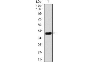 Western blot analysis using DLL4 antibody against HEK293 (1) and DLL4 (AA: 313-439) -hIgGFc transfected HEK293 (2) cell lysate. (DLL4 antibody)