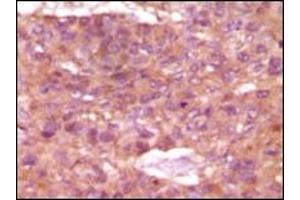Immunohistochemistry (IHC) image for anti-Steroid Receptor RNA Activator 1 (SRA1) (truncated) antibody (ABIN2464107) (SRA1 antibody  (truncated))