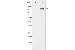 Western Blotting (WB) image for anti-Insulin Receptor Substrate 1 (IRS1) (pSer636) antibody (ABIN6255436)