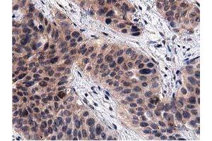 Image no. 3 for anti-Acyl-CoA Thioesterase 12 (ACOT12) antibody (ABIN1496414) (ACOT12 antibody)