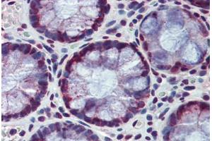 Human Colon: Formalin-Fixed, Paraffin-Embedded (FFPE) (HDAC1 antibody  (AA 271-477))