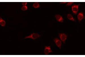 ABIN6276214 staining HuvEc by IF/ICC. (SMO antibody  (N-Term))