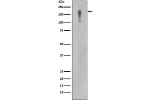 Western blot analysis of EGFR in A431 cell lysate.