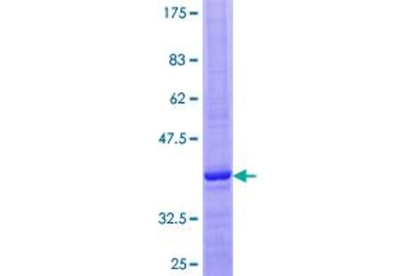 GnRH2 Protein (AA 1-120) (GST tag)