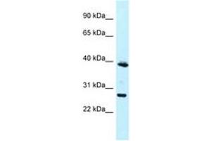 Image no. 1 for anti-Melanoma Antigen Family F, 1 (MAGEF1) (N-Term) antibody (ABIN6747857)
