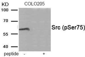 Western blot analysis of extracts from COLO205 tissue using Src (Phospho-Ser75) antibody. (Src antibody  (pSer75))